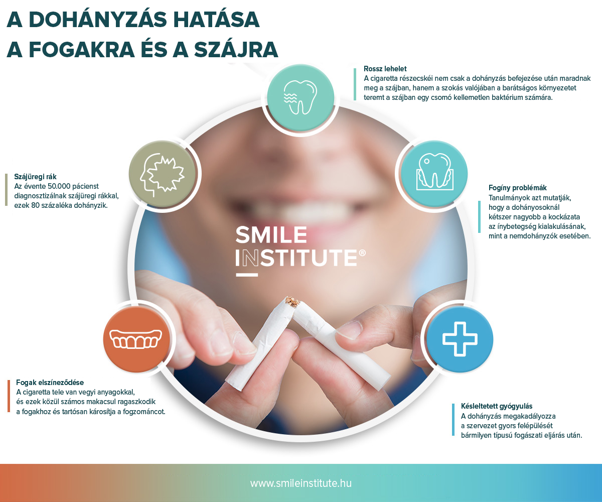 Smile Institute® BLOG - A DOHÁNYZÁS HATÁSA A FOGAKRA ÉS A SZÁJÜREGRE