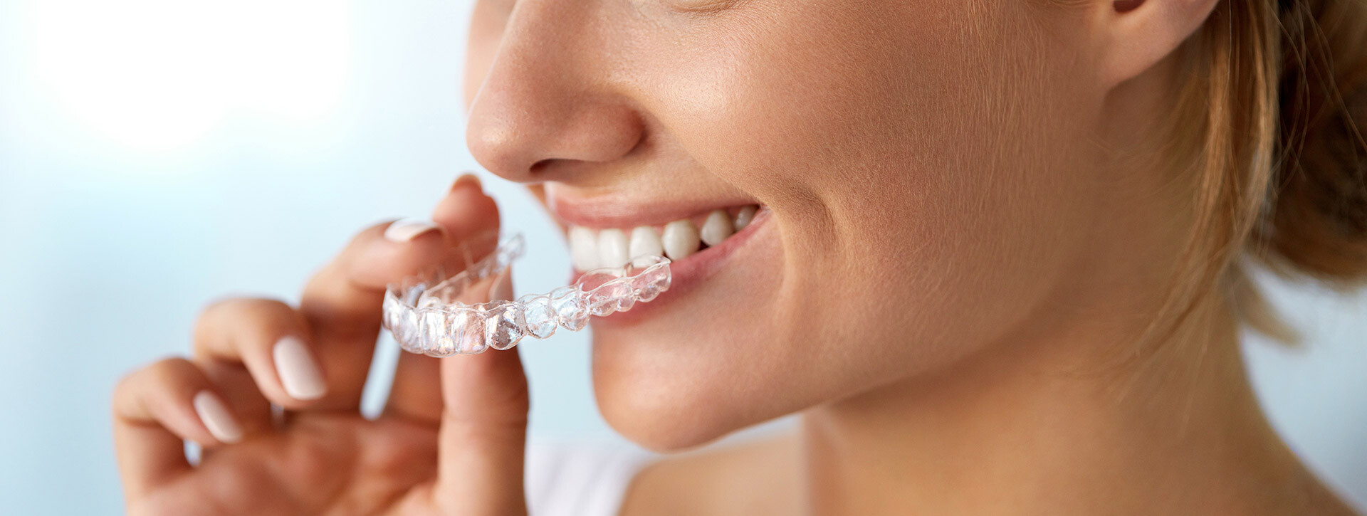Smile Institute Blog - Bármely életkorban lehet szabályoztatni a fogakat? Smile Institute Blog - Bármely életkorban lehet szabályoztatni a fogakat?