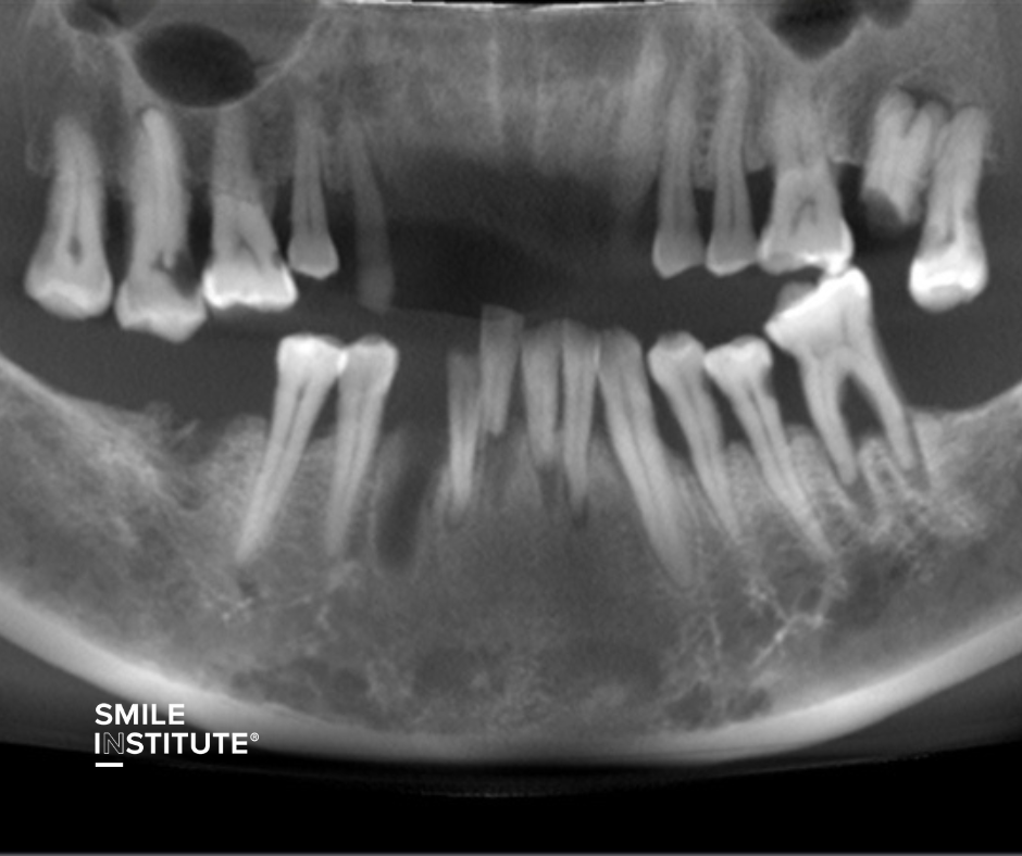 Smile Institute® - Fogászati CT – A pontos diagnózis és személyre szabott kezelés alapja