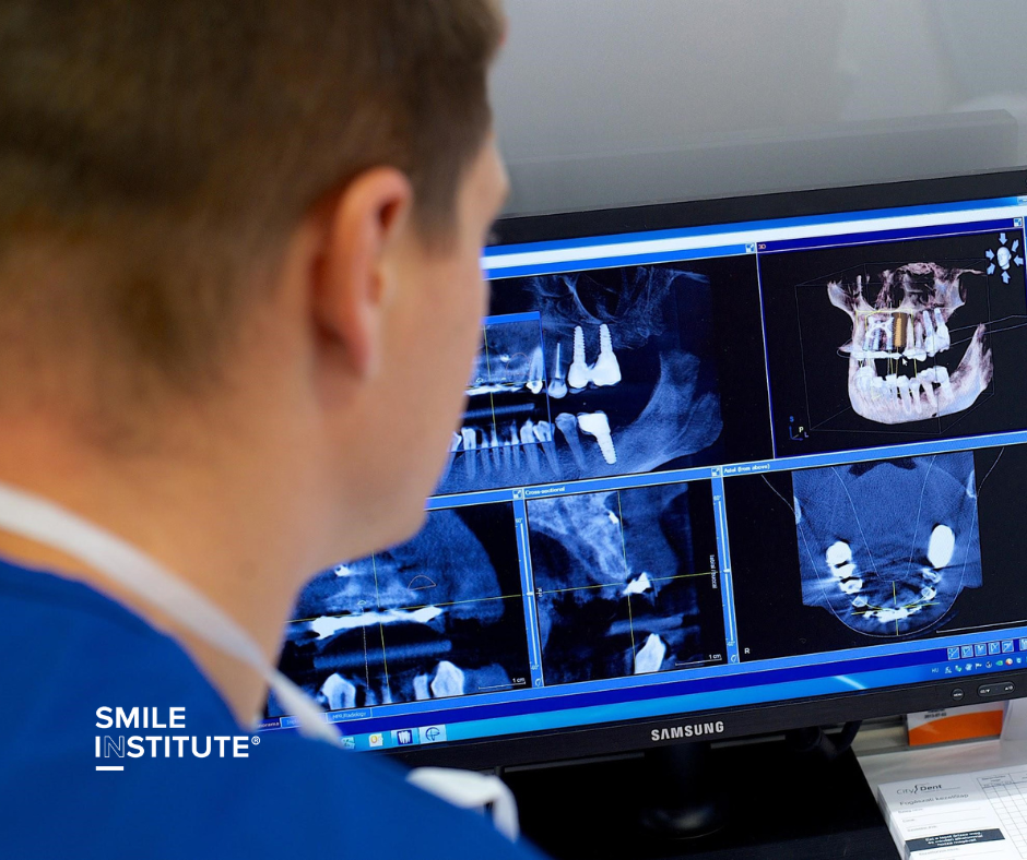 Szájsebészet Budapesten – Mikor van rá szükség, és hogyan zajlik egy szájsebészeti beavatkozás? - Smile Institute Szájsebészet Budapesten – Mikor van rá szükség, és hogyan zajlik egy szájsebészeti beavatkozás? - Smile Institute