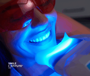 Smile Institute Blog - Fogfehérítés nyár előtt – Miért éri meg a rendelői eljárást választani?