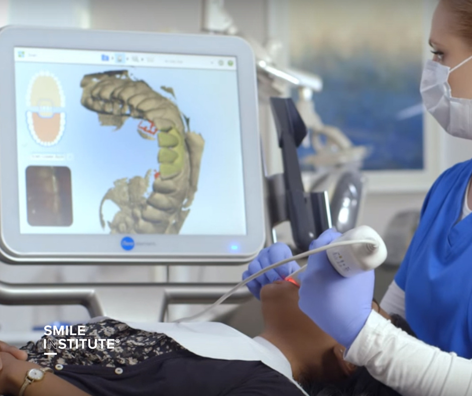 iTero szkenner – a fogszabályozás új dimenziója - Smile Institute Blog