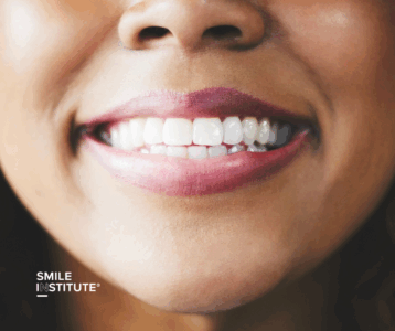 Keratin a zománc védelmében – gyapjú és haj a fogkrémekben? - Smile Institute blog