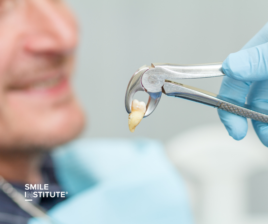 Gyorsabb regeneráció bölcsességfog eltávolítás után – hogyan segíthet a Novosseum Dental? - Smile Institute Blog Gyorsabb regeneráció bölcsességfog eltávolítás után – hogyan segíthet a Novosseum Dental? - Smile Institute Blog