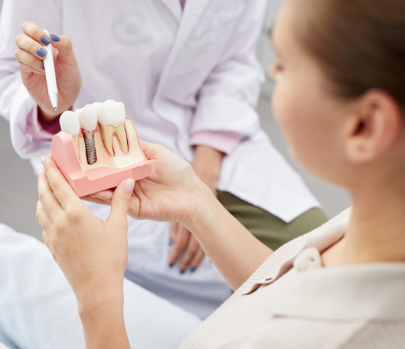 Smile Institute - Fogászati implantátum beültetés