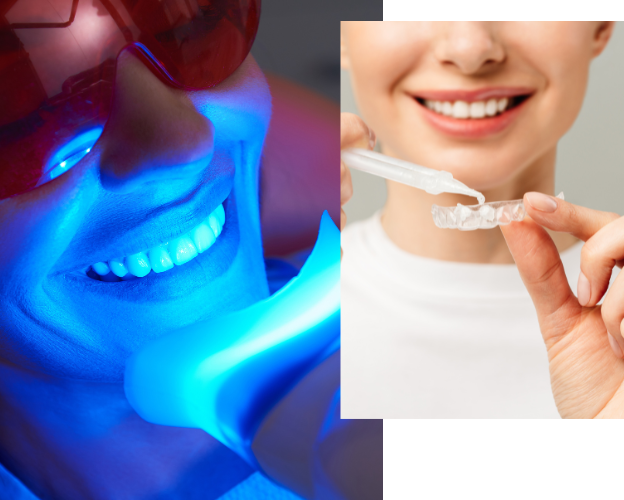 Smile Institute - fogfehérítés Budapest