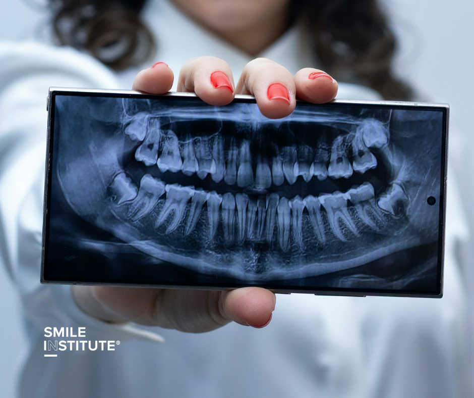 Őszi fáradtság vagy rejtett fogászati probléma? - Smile Institute Blog Őszi fáradtság vagy rejtett fogászati probléma? - Smile Institute Blog