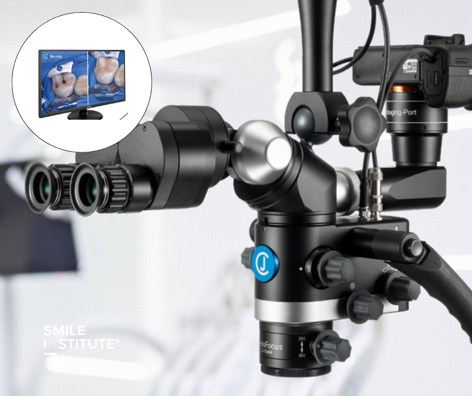 Mikroszkópos gyökérkezelés vagy hagyományos? – Melyikre van szükségem? - Smile Institute Blog