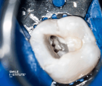 Miért számít ennyire a mikroszkóp minősége? – Bemutatjuk a Flexion Advanced SensorUnit + SONY kamerát - Smile Institute Blog