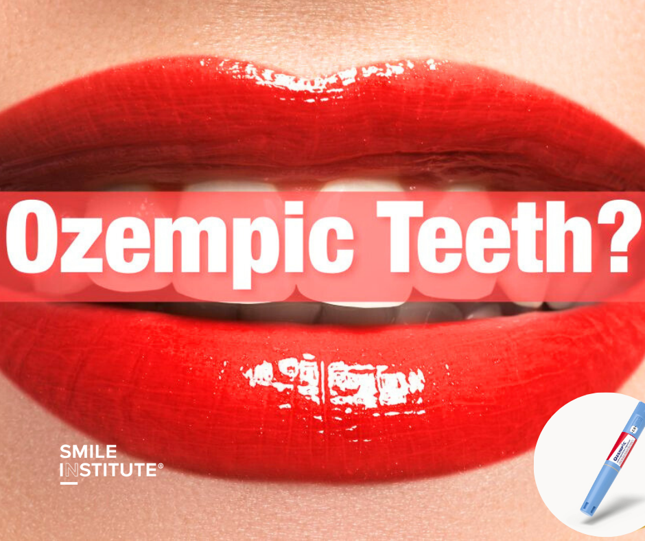 Ozempic Teeth – Valóban károsíthatja a fogyókúrás injekció a fogakat? - Smile Institute Blog