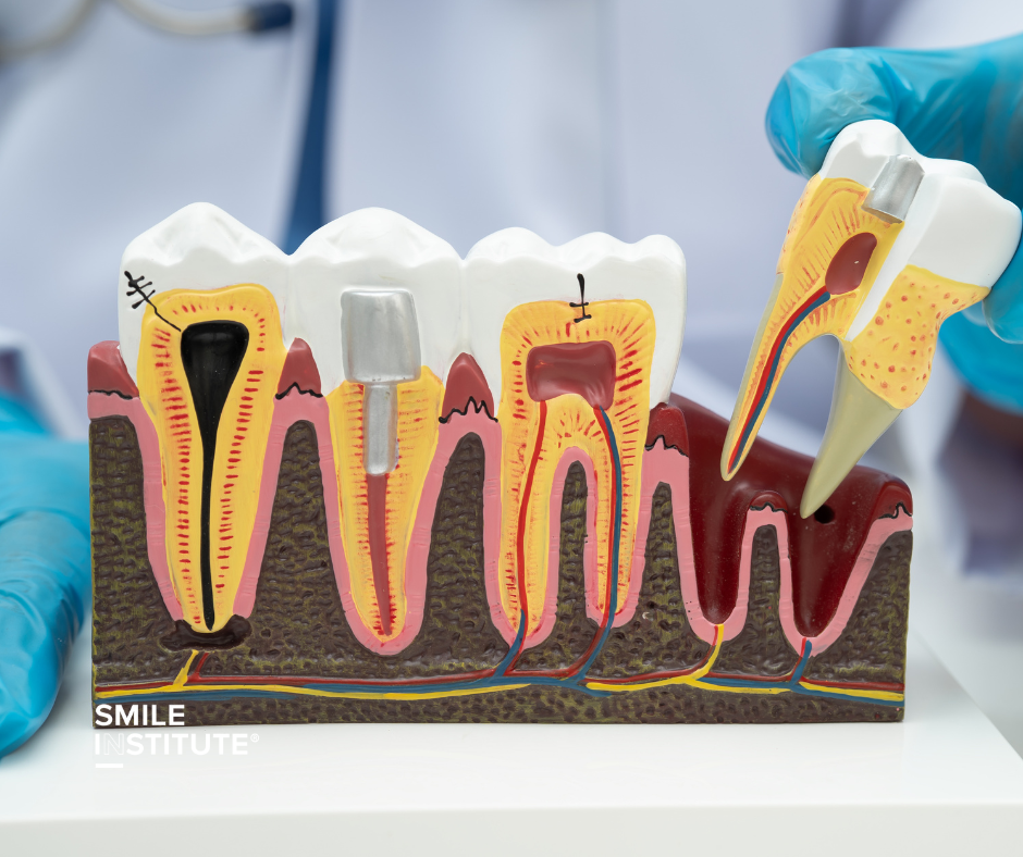 Szájsebészet Újpesten – mikor nem elegendő az általános fogászati ellátás? - Smile Institute Blog