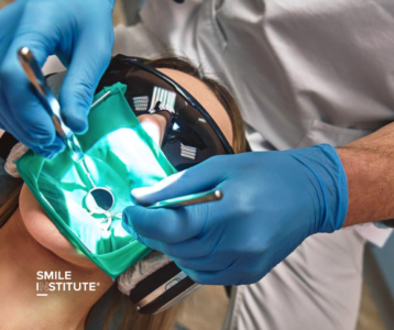 Mennyi ideig tart a gyökérkezelés? – Idő, alkalmak és gyógyulás