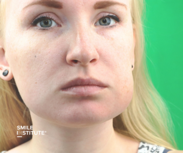 Bedagadt az arcom – ez lehet a fogamtól? Mikor kell azonnal orvoshoz fordulni? - Smile Institute Blog