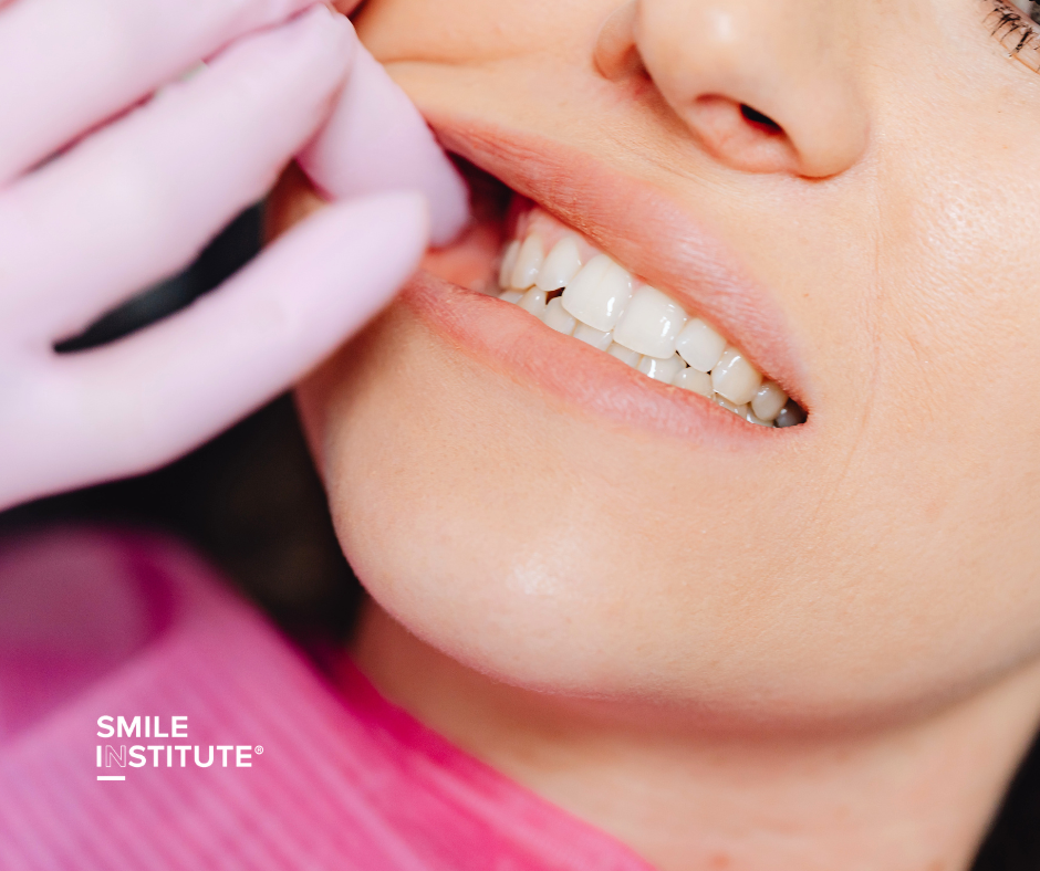 Miért lazulnak meg vagy esnek ki fogpótlások évekkel később? - Smile Institute Blog